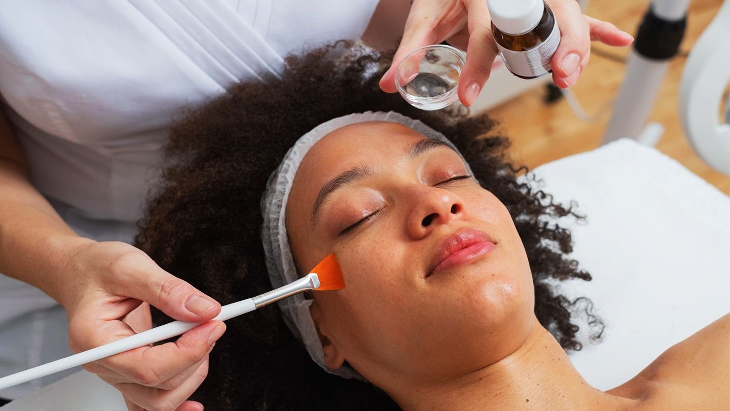 Are Chemical Peels Safe for Dark Skin