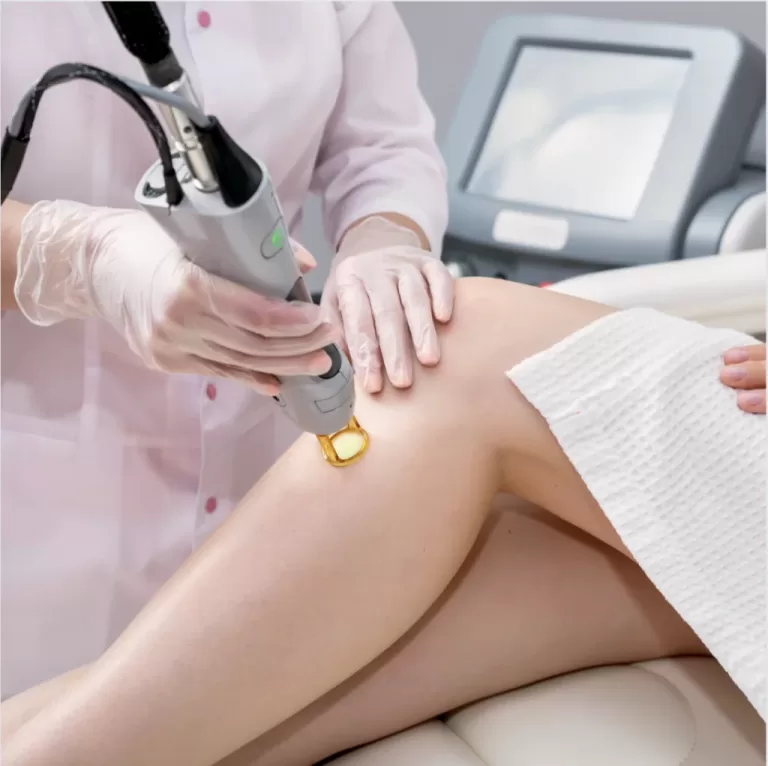 How Many Sessions for Laser Hair Removal?