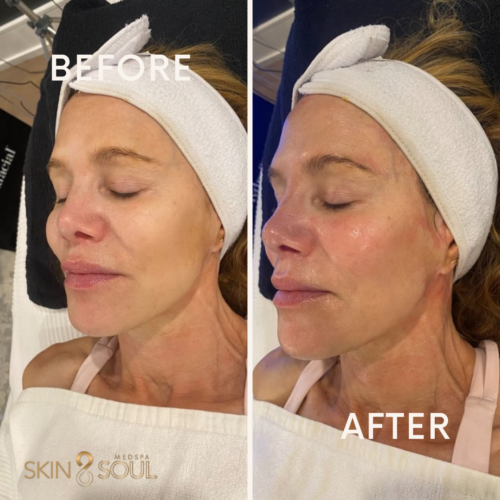 Before after minimal skincare Instagram post