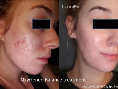 BALANCE B&A