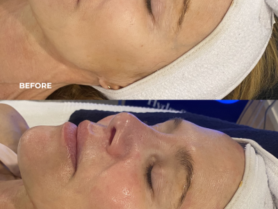 Before and After horizontal (Instagram Post (45))